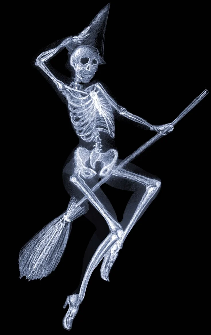 Скелет рентген. Поздравление